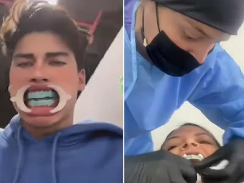 Al igual que La Divaza: joven va al dentista y es sorprendida por un temblor en plena consulta