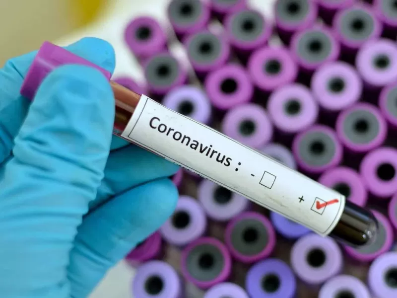 coronavirus en Argentina, Coronavirus Argentina. Primer caso de coronavirus en Argentina, Se confirma coronavirus en Arg